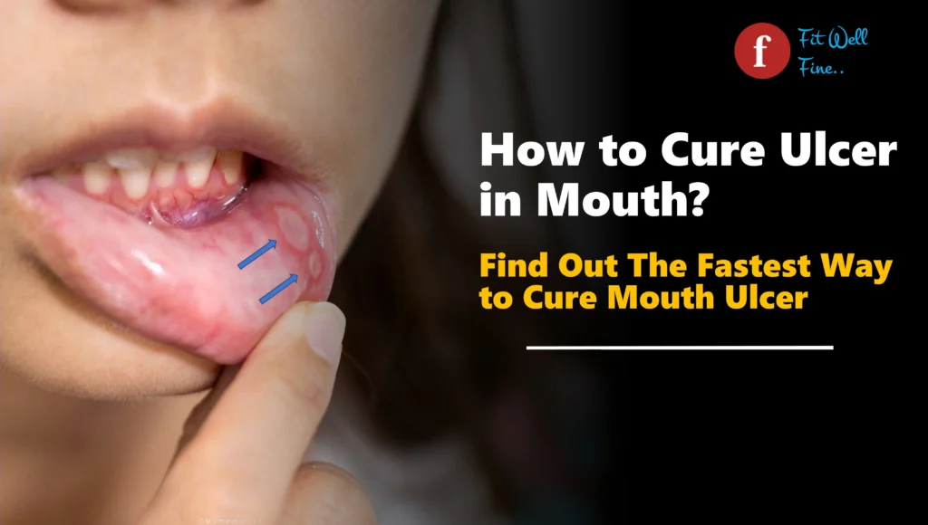 How to Cure Ulcer in Mouth