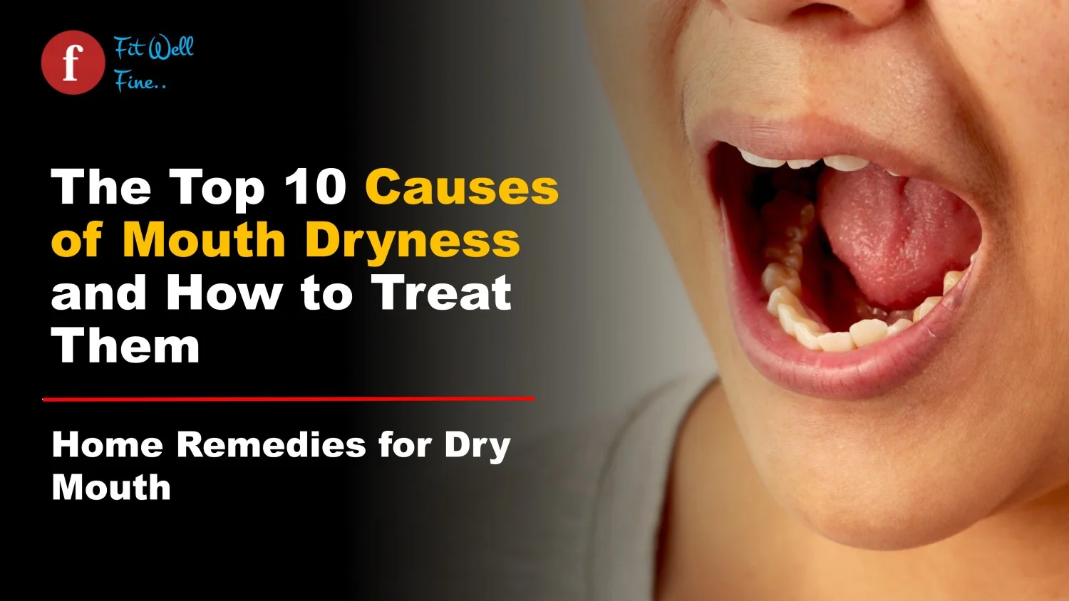 Causes of Mouth Dryness